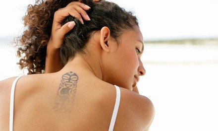 One Laser Tattoo-Removal Treatment for Up to 4 or 12 Sq. In. at Style MedSpa (Up to 67% Off)