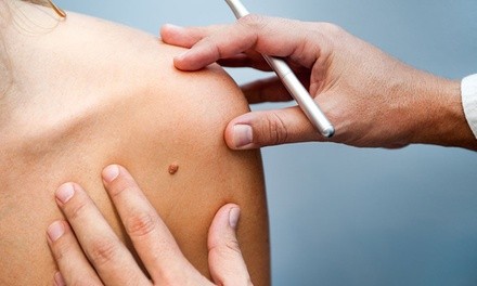 One, Two, or Three Skin Tag Removal Sessions at The Haven At 1857 (Up to 64% Off)