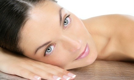 $106 for One IPL Photofacial at Sarah Laser Medspa ($300 Value)