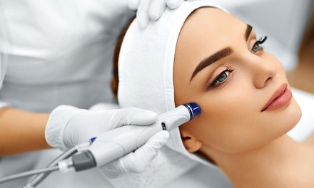 One Microdermabrasion Treatments at Sarah Laser Medspa (Up to 48% Off)