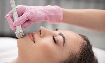 One Chemical Peel, Bightening Lift Treatment, or Microdermabrasion at Crystallize Spa & Salon (Up to 62% Off)