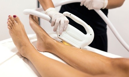 Six Laser Hair-Removal Sessions on One Small, Medium, or Large Area at Bloom (Up to 84% Off)