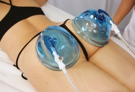 One or Two 30-Minute Vacuum Butt Lifts w/ Thermal Cellulite Treatment and More at Persona MedSpa (Up to 80% Off)