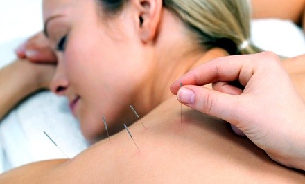 Up to 60% Off on Acupuncture Services at Dynamic Healing Acupuncture