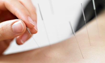 Up to 60% Off on Acupuncture Services at Lighthouse Wellness Center