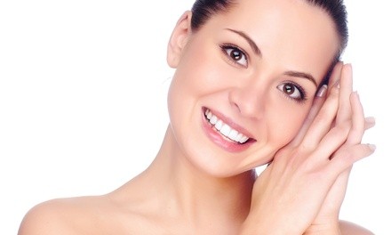 One VI Chemical Peel at Lotus Laser & Spa (Up to 48% Off). Two Options Available.