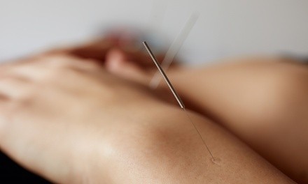 One or Six Acupuncture Sessions with Consultation at Cindy Haxel Acupuncture (Up to 52% Off)