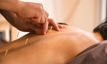 One or Two Acupuncture Treatments with Consultation at Ease Acupuncture Wellness (Up to 80% Off)