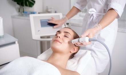 One IPL Photo Facial at Evo Powered by L Aesthetics (Up to 76% Off)