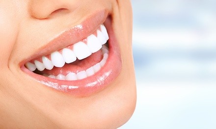 $99 for 30-Minute LED Teeth Whitening at John W. Tyrone M.D. Aesthetics & Plastic Surgery ($175 Value)