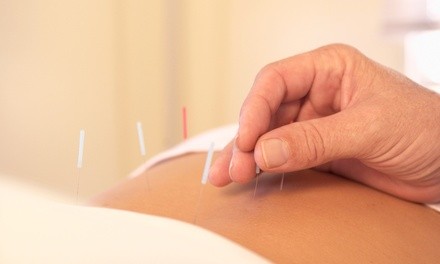 One or Three Acupuncture Treatments at Nan's Acupuncture and Wellness Clinic (Up to 61% Off)