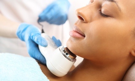 One or Two DermaDisc Exfoliating Treatments with Enzyme Peels at Spa Nova (Up to 30% Off)