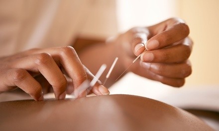 One, Two, or Three Acupuncture Sessions with Initial Consultation at Unsook Park's Acupuncture (Up to 78% Off)