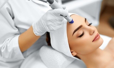 1 or 3 Microdermabrasion Treatments with Optional Hydrating Facials at Pro Skincare & Day Spa (Up to 80% Off)