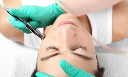 One 60-Minute Microdermabrasion Facials at The Clearing Spa (Up to 62% Off)
