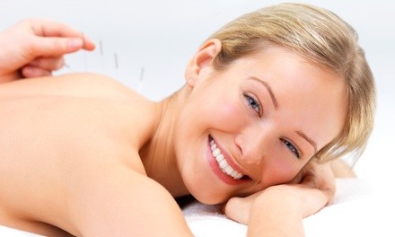 One Acupuncture Session at Bright Family Acupuncture (Up to 80% Off)