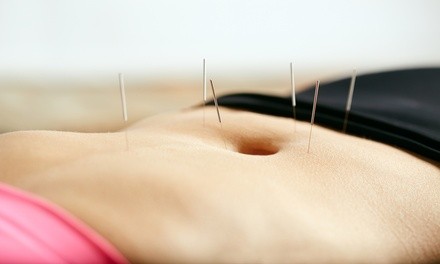 Up to 70% Off on Acupuncture Services at Olinda Acupuncture & Wellness Clinic