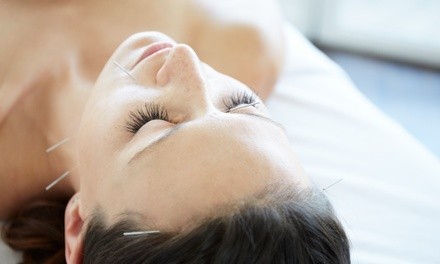 One 60-Minute Acupuncture Treatments with Initial Consultation at Healing Remedies (Up to 74% Off)