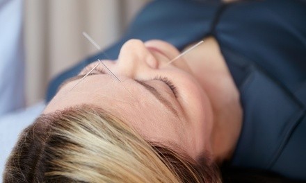 One Acupuncture Session with Optional Massage Therapy at Life Tree Wellness Center (Up to 75% Off)