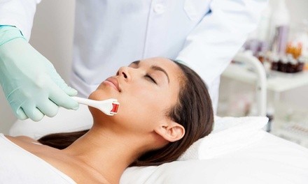 One or Two 45-Minute Microneedling Treatments at Amour Propre (Up to 52% Off)