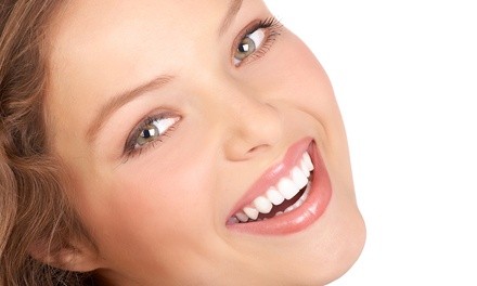 30- or 60-Minute Express or Signature Teeth Whitening for One or for Couples at Smile Labs (Up to 64% Off)