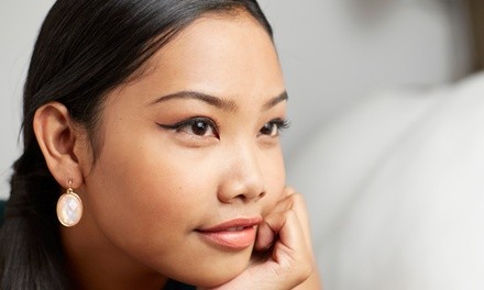 $167.05 for 20 Units of Botox at Total Med Solutions (Up to $400 Value)