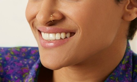 $44 for One In-Office Zoom! Teeth Whitening Treatment with Consultation ($280 Value)