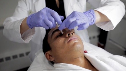 Up to 70% Off on Micro-Needling at Yesenia Saad Modern Health and Beauty