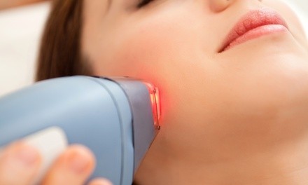 One Lumecca IPL Treatment for Full Face or Face and Neck at RegenMD (Up to 63% Off)