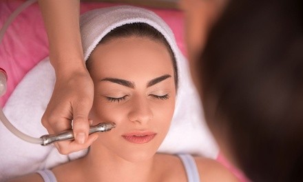 One Microdermabrasion Treatment with Micro Peel Enzymes at Allure Skincare Studio (76% Off)