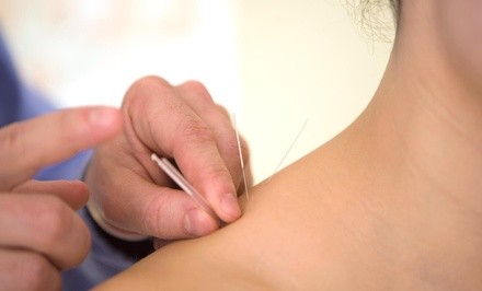 
$400 for Six Acupuncture Sessions at AcuMed ($800 Value)
