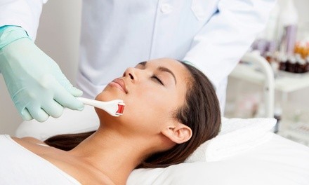 One Microneedling Treatment with Optional PRP Facial at Revive Skin & Body Med Spa (Up to 42% Off)