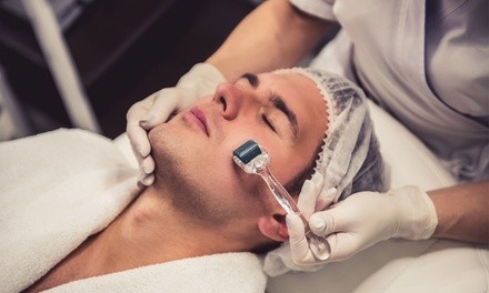 One or Two Microneedling Treatments with Facial and Dermaplaning at Cameron Park Esthetics (Up to 41% Off)