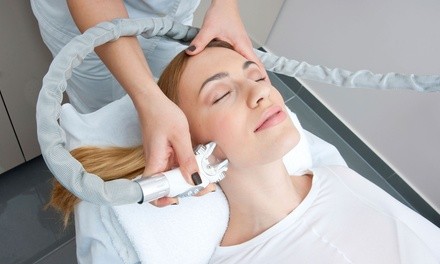 One IPL Photo Facial Treatment at McLean Body Contouring & Laser Center (Up to 75% Off)