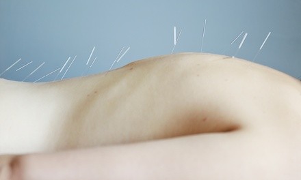 One, Three, or Five  Acupuncture Sessions at Body and Spine Solutions (Up to 76% Off)