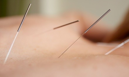 Acupuncture Sessions at Dynamic Health Chiropractic and Acupuncture (Up to 72% Off). Two Options Available.