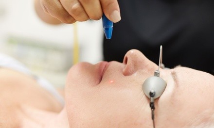 Laser Treatment to Reduce Pores or Wrinkles and Acne Scars at California Dermatology Institute (Up to 61% Off)