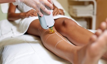 Six Laser Hair-Removal Sessions at Eye Candy Rejuvenation Center (Up to 62% Off). Three Options Available.