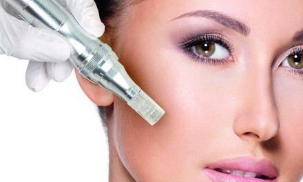 $449 for One Platelet-Rich Plasma Facial Treatment at Kingston Crossing Wellness Clinic ($850 Value)