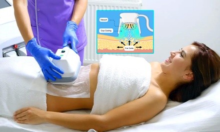 Cryo-Freeze Body Shaping at Vero Derm Aesthetic and Wellness Center (Up to 62% Off). Three Options Available.