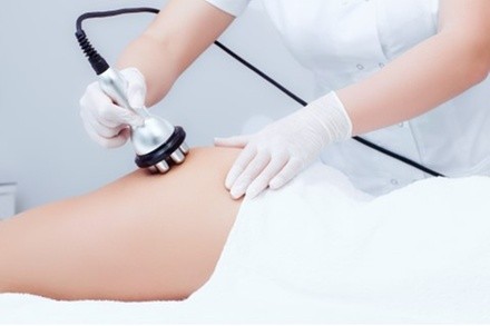 One, Two, or Four Radio-Frequency Skin-Tightening Treatments at Face and Body Aesthetics (Up to 30% Off)