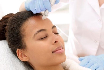 One or Two PRP Facials with MIcroneedling and Consultation at Dr. Hong Med Spa (Up to 36% Off)
