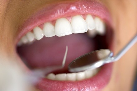 Up to 76% Off on Dental Implant / Corona / Veneer at Omni Dental Group