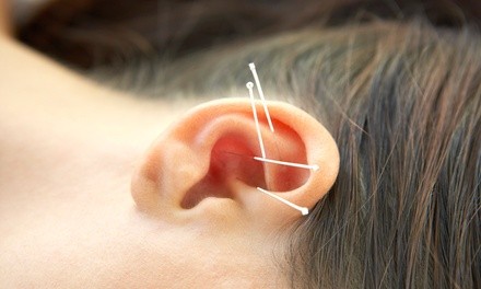 $39 for 60-Minute Ear Acupuncture Session at Mai Thai Yoga Massage ($60 Value)