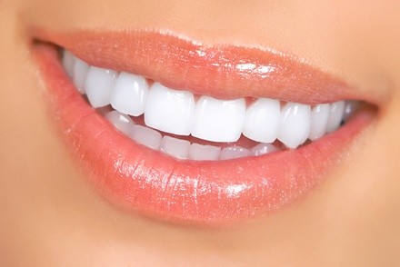 Up to 56% Off on Teeth Whitening - In-Office - Branded (Beyond, Power) at Brows by Ami