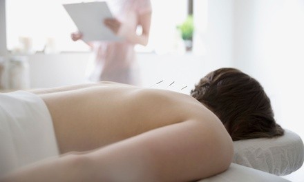 One or Two 60-Minute Acupuncture Sessions at Advanced Therapies (Up to 32% Off)