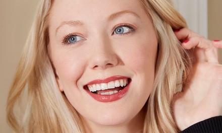 Up to 10% Off on Teeth Whitening - Traditional at Smile with 3CHICAS beauty lounge