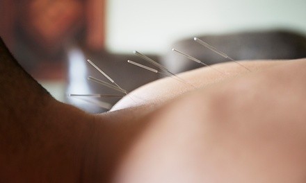 One 45–60-Minute Acupuncture Treatments with Initial Consultation at Acupuncture (Up to 59% Off)