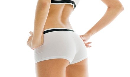 Two, Four, or Six Lipolaser Body-Contouring Treatments at European Beauty Center (Up to 81% Off)