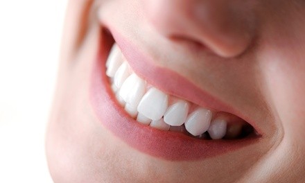 $30.40 for Invisalign Package at West LA Dental Health Center ($2,255 Value)